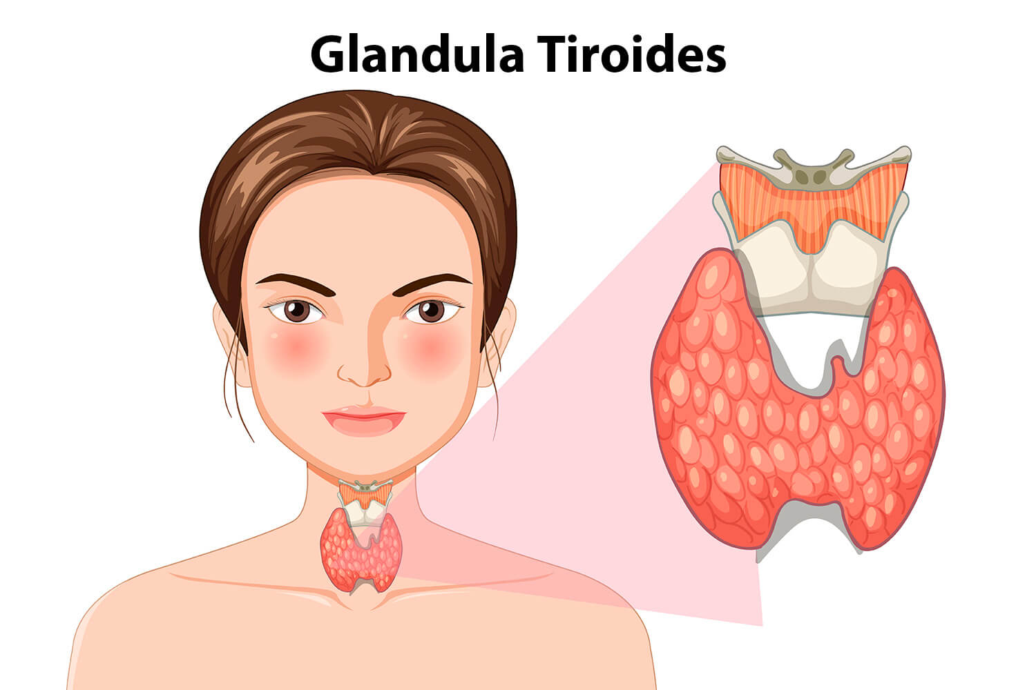 Diferencias entre hipotiroidismo e hipertiroidismo