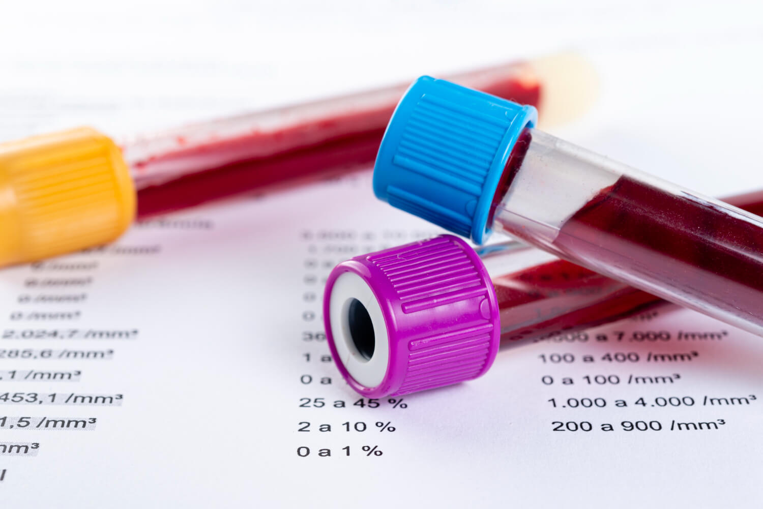 Essential Pediatric Tests: Complete Blood Count, Blood Chemistry, Lipid Profile, and Urine Tests