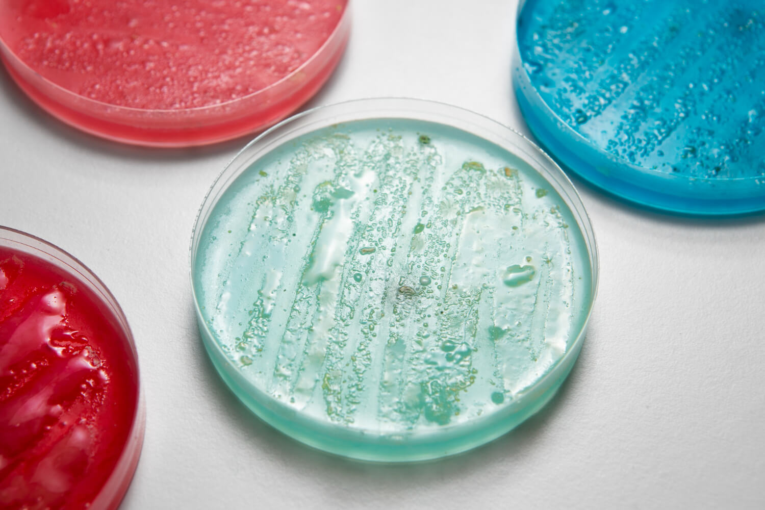 Cultivo bacteriano en laboratorio clínico para identificación microbiana. - Bacterial culture in a clinical laboratory for microbial identification.