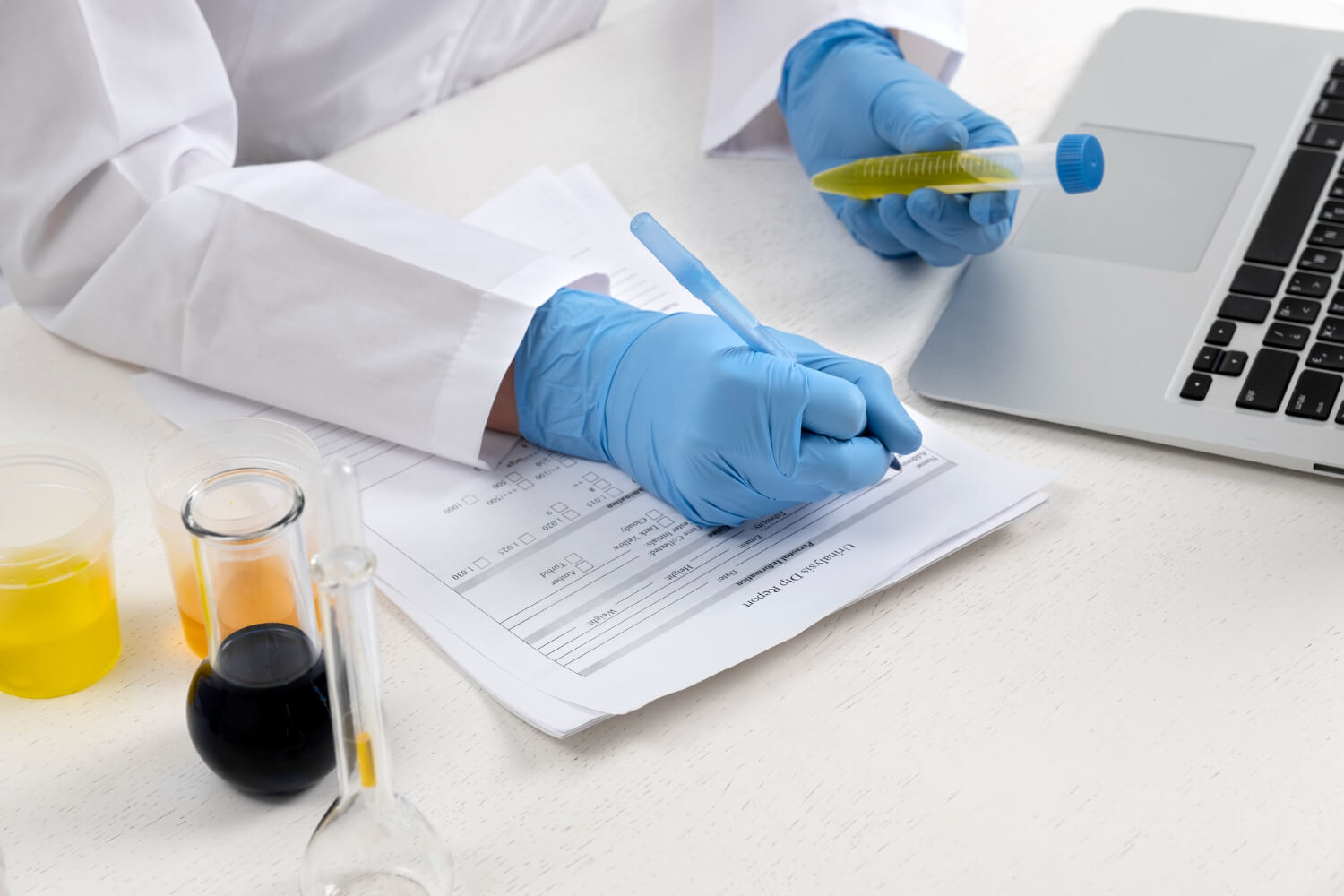 perfil hepático mostrando ALT, AST, bilirrubina y albúmina como principales pruebas de función hepática - Liver profile showing ALT, AST, bilirubin and albumin as the main liver function tests