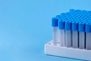 Serologías infecciosas en laboratorio clínico en Venezuela para detectar hepatitis y dengue - Infectious serology tests in clinical laboratories in Venezuela to detect hepatitis and dengue