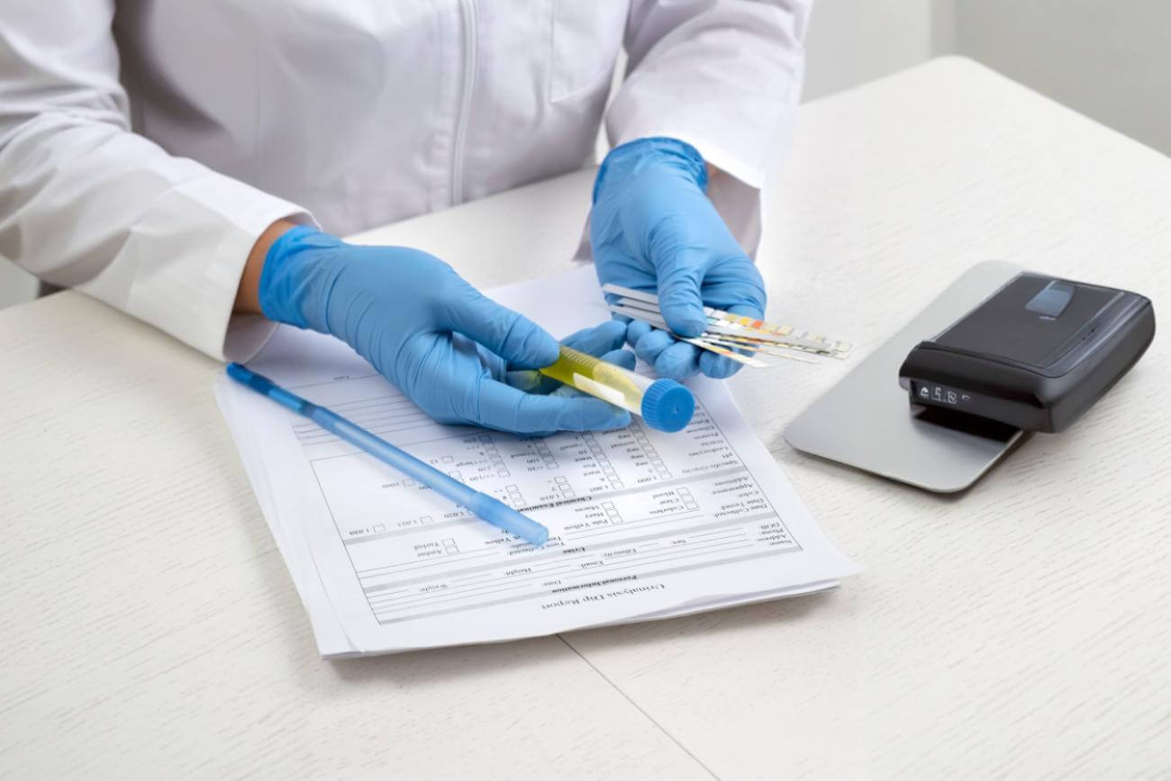 Principales marcadores tumorales utilizados para diagnóstico y seguimiento del cáncer - Main tumor markers used for cancer diagnosis and monitoring