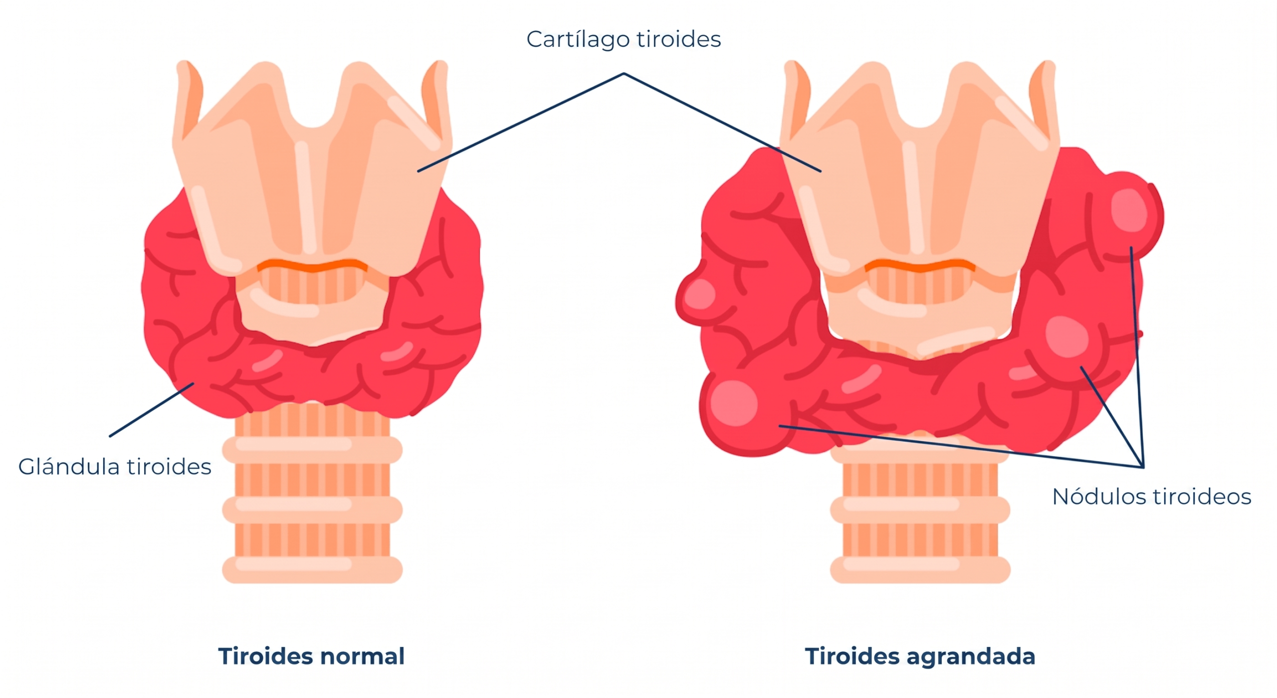 Ubicación de la glándula tiroides y salud hormonal - Location of the thyroid gland and hormonal health