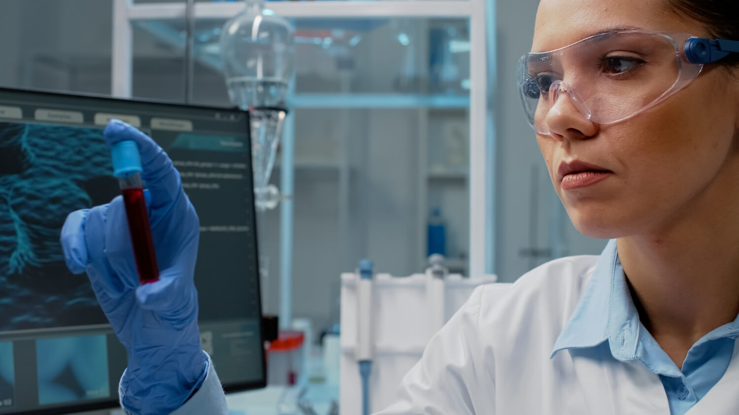 Analisis de sangre para deficit de vitaminas en laboratorio clinico en Venezuela - Blood test for vitamin deficiency in clinical laboratory in Venezuela