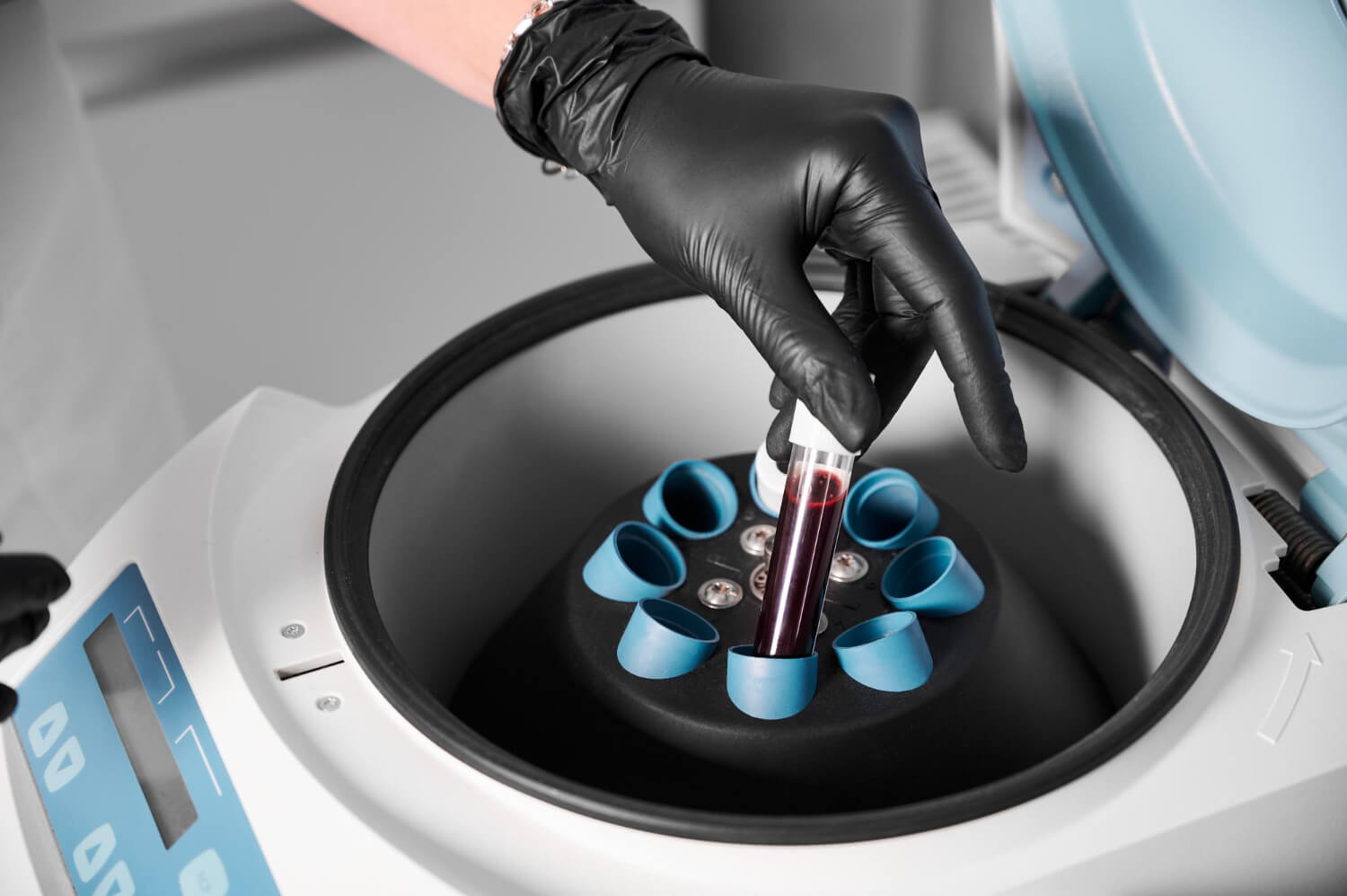 Análisis de sangre para medir colesterol y triglicéridos en el Laboratorio Clínico La Trigaleña - Blood analysis to measure cholesterol and triglycerides at Laboratorio Clínico La Trigaleña